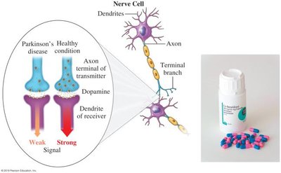 Diagram showing dopamine signaling in Parkinson's disease and healthy condition