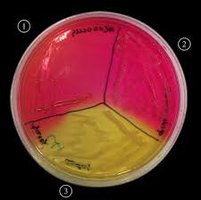 Mannitol Salt Agar (MSA) plate