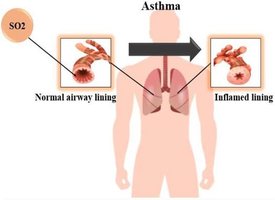 Diagram showing SO2 inhalation and its effect on asthma