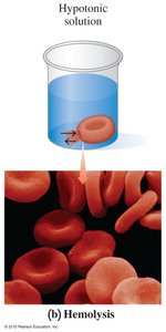 Hypotonic solution and hemolysis of red blood cells