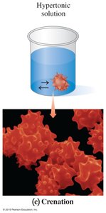 Hypertonic solution and crenation of red blood cells