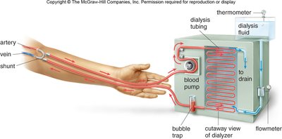 Hemodialysis machine setup