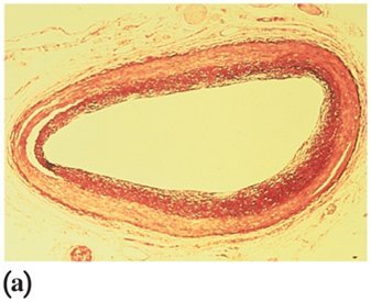 Normal artery