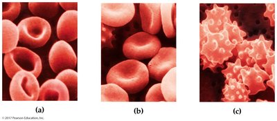 Red blood cells: isotonic, hypotonic, hypertonic (labeled)