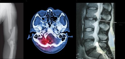 Medical imaging: X-ray, CT scan, MRI