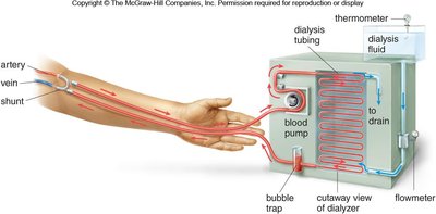 Hemodialysis process