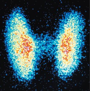 PET scan image showing distribution of radioisotope in tissue