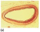 Normal artery cross-section