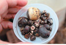 Bile salt structure and gallstones