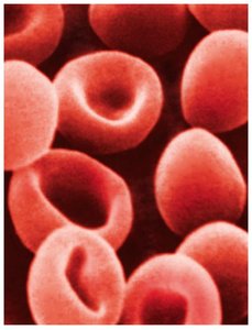 Red blood cells, relevant to osmosis and solution tonicity