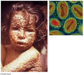 Images of smallpox infection and virus particles