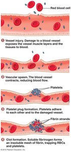 Stages of hemostasis: vascular spasm, platelet plug, clot formation