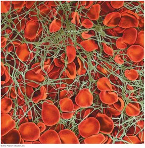 Microscopic image of blood clot with fibrin threads