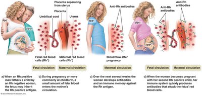 Rh factor and maternal-fetal circulation