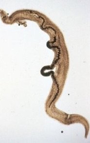 Flame cell system in Planaria