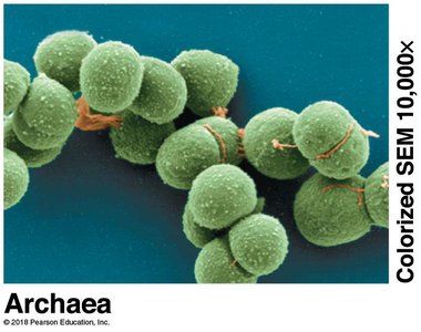 Microscopic image of archaea