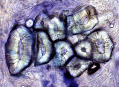 Astrosclereids in Nymphaea leaf cross-section