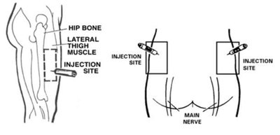 Injection site selection for auto-injectors