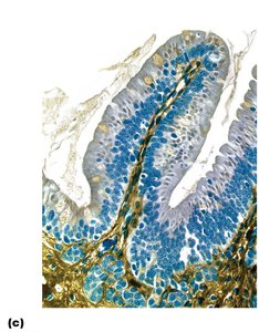Histological section showing villi and absorptive cells
