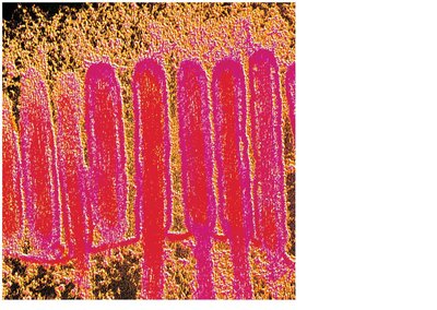 Microvilli forming the brush border on enterocytes