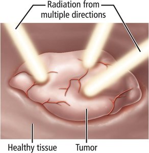 Targeting tumors with radiation