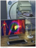 Nuclear medicine imaging setup