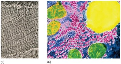 Micrograph of cellulose fibrils