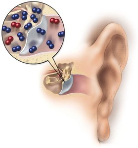 Pressure imbalance in the ear