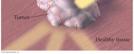 Tumor and healthy tissue under radiation