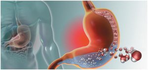 Stomach acid and heartburn illustration