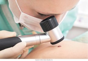 Skin examination with magnifying lens