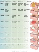 Types of skin lesions
