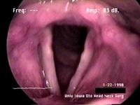 Vocal cords within the larynx