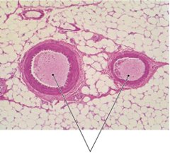 Histological section showing artery, vein, and lumen