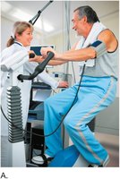 Bicycle exercise stress test