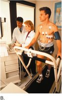 Treadmill exercise stress test with ECG monitoring