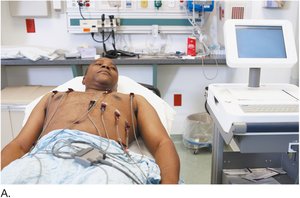 Precordial chest leads for ECG