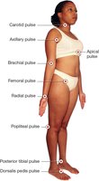 Diagram of pulse points on the body