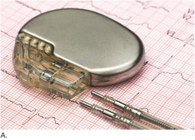 Pacemaker device and wires