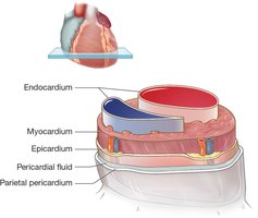 Cross-section of the heart wall showing pericardium, myocardium, and endocardium
