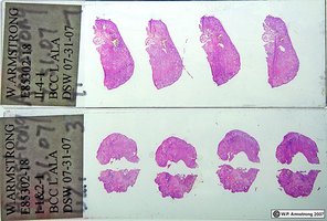 Histology slides showing tissue samples