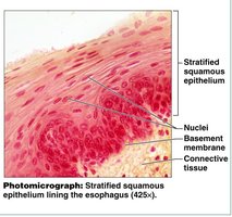Photomicrograph of stratified squamous epithelium lining the esophagus