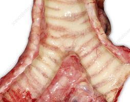 Dissected trachea and bronchi