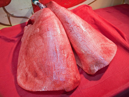 Lung anatomy and pleura