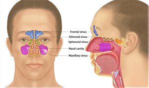 Sinuses and nasal cavity