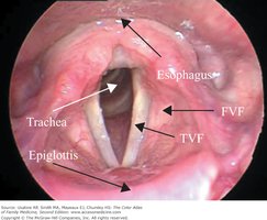Transverse view of larynx and epiglottis