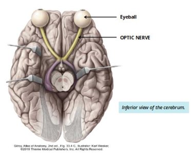 Inferior view of the cerebrum showing the optic nerve