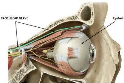 Lateral view of the orbit showing the trochlear nerve