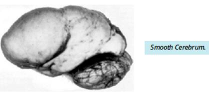 Lobes of the cerebrum