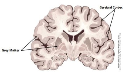 Coronal section of cerebrum: white matter